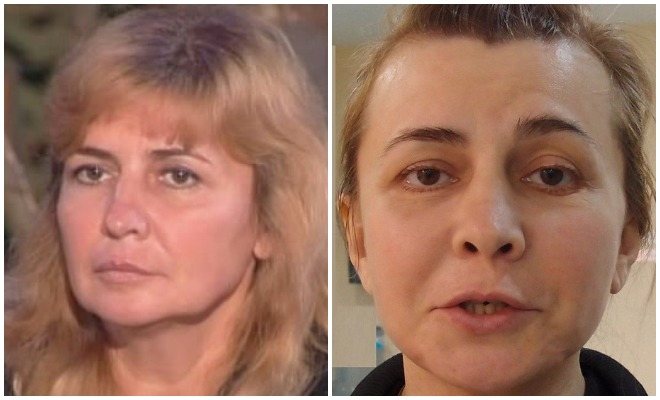 Ирина Агибалова до и после пластики