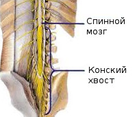 Синдром конского хвоста Синдром конского хвоста
